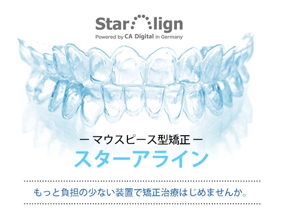 マウスピース型矯正 スターアライン